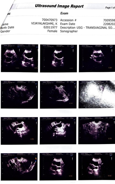 File:Pap smear.pdf